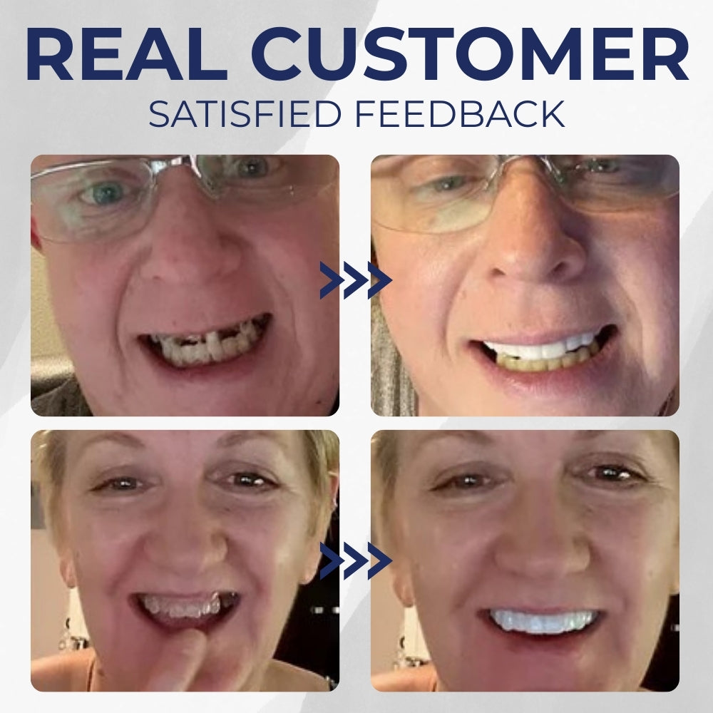 Zenyric™ - Denture Set